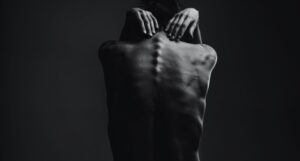 black and white image of a person with their head bent forward as seen from behind. the person is topless and the bones of their spine and ribs are poking our from under from their skin