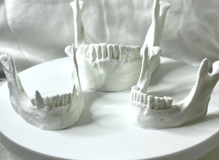 a photo of 3d printed jawbone stands