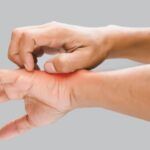 someone with pale skin scratching their hand